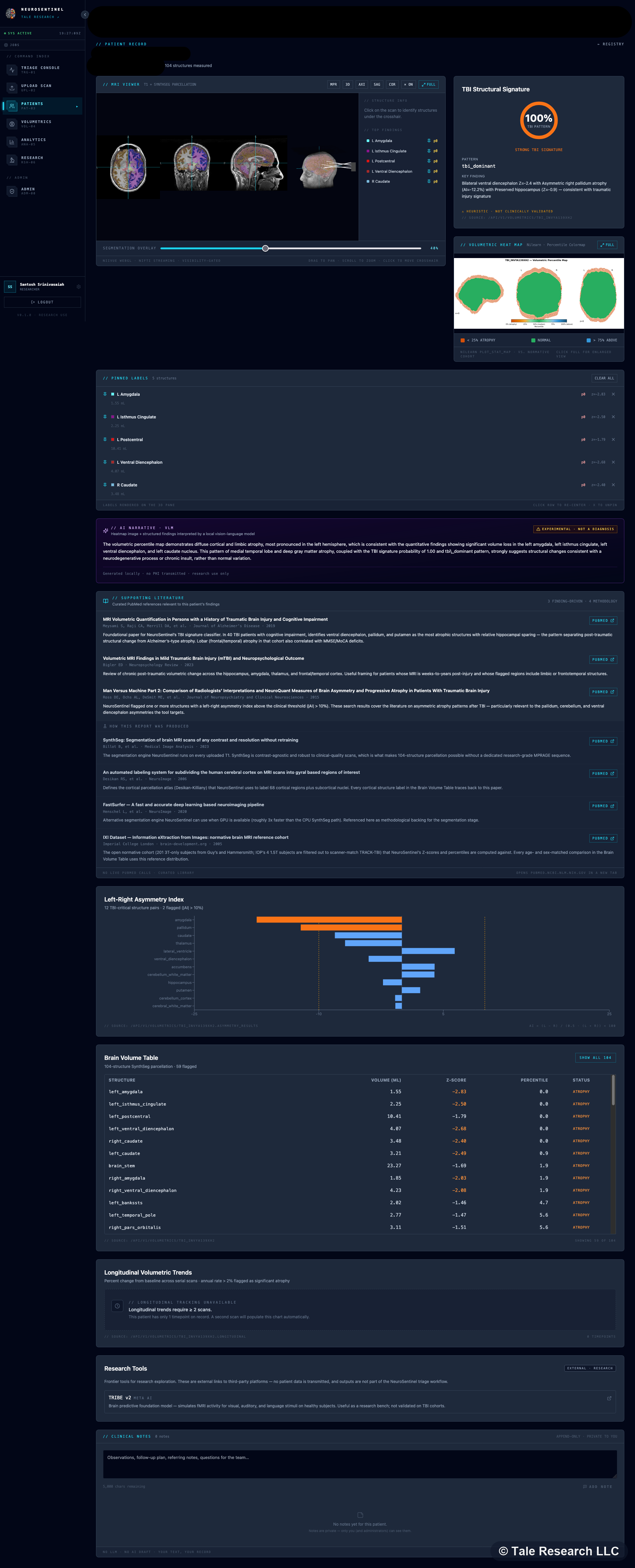 NeuroSentinel end-to-end dashboard: scan viewer with structural signature, parcellated regions, asymmetry index, brain volume table, longitudinal trends, and research tools
