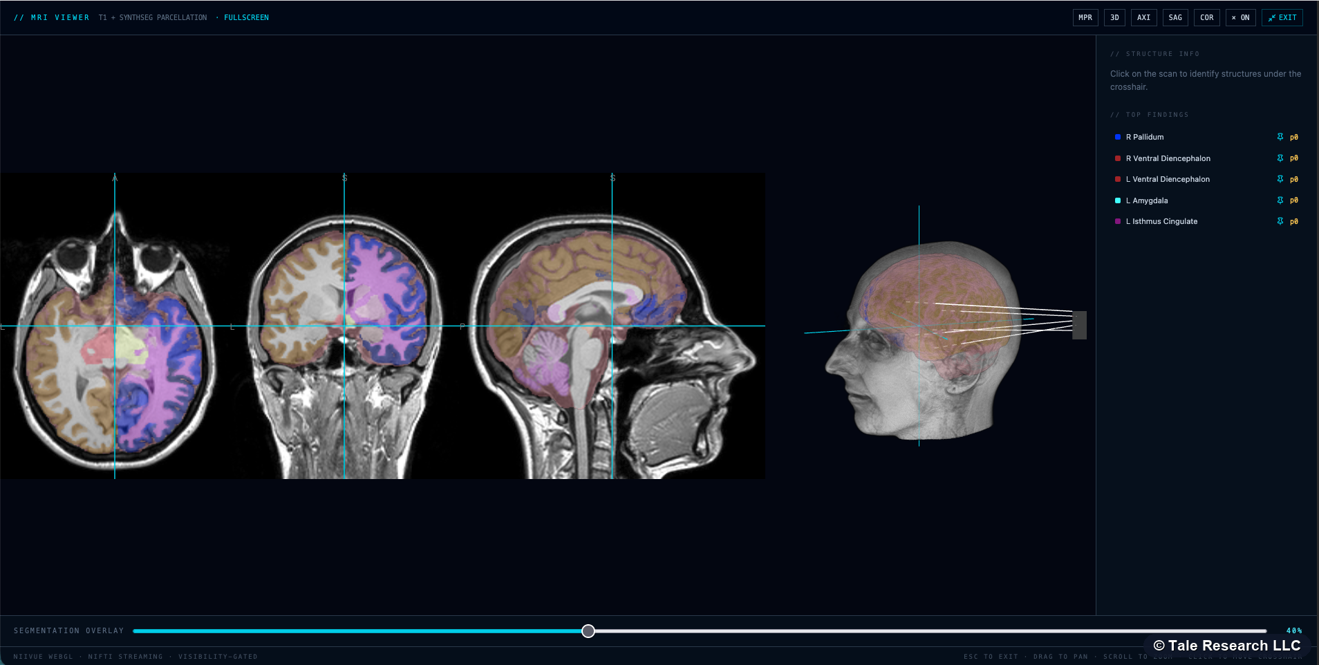 NeuroSentinel multi-plane MRI viewer with structural overlays and 3D head reconstruction